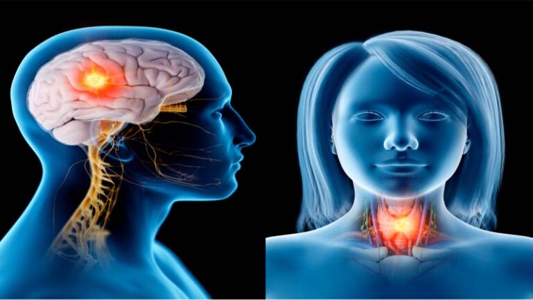 विश्व हेड एंड नेक कैंसर दिवस: इलाज के बाद भी 20–40% मरीजों में लौट सकता है कैंसर, मुंह के छाले को न करें नजरअंदाज